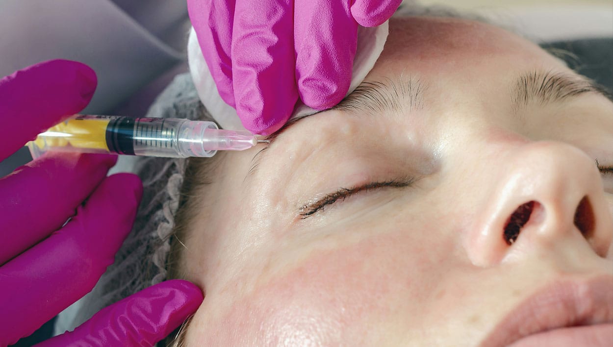 botox-inyectable